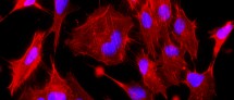 Human skin fibroblasts