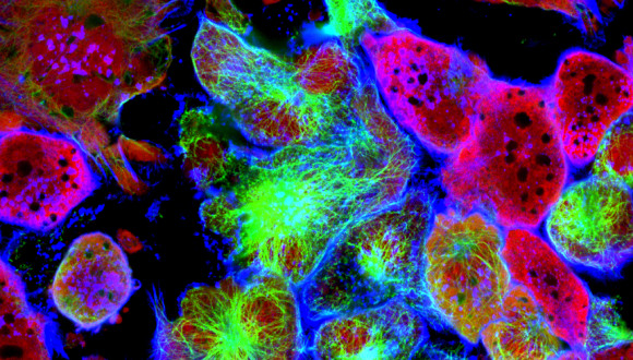 Cell Based High Content Imaging: From Outstanding Images to Large Numbers to Biological Relevance