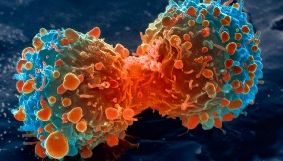 Cancer Research